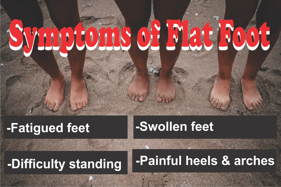 Flat Foot Pain Relief