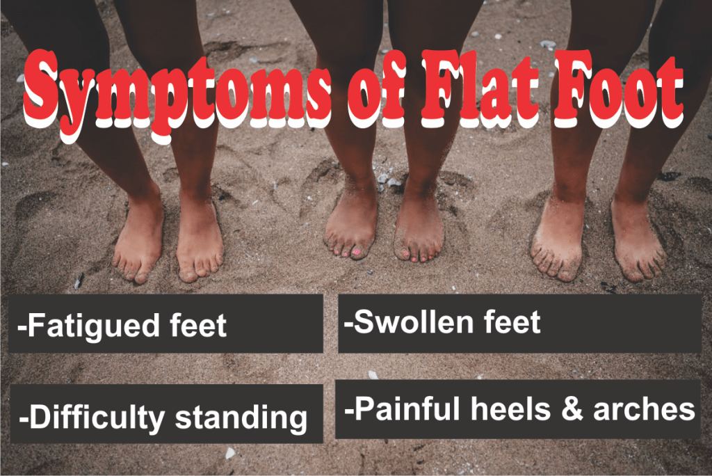 Flat Foot Pain Relief 23
